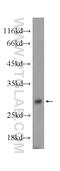 Testis Expressed 38 antibody, 24429-1-AP, Proteintech Group, Western Blot image 