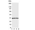 Mitochondrial brown fat uncoupling protein 1 antibody, R31087, NSJ Bioreagents, Western Blot image 
