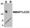 Microtubule-associated proteins 1A/1B light chain 3C antibody, 7583, ProSci Inc, Western Blot image 