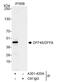 DNA Fragmentation Factor Subunit Alpha antibody, A301-420A, Bethyl Labs, Immunoprecipitation image 
