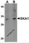 Spindle And Kinetochore Associated Complex Subunit 1 antibody, 5401, ProSci, Western Blot image 