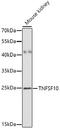 TNF Superfamily Member 10 antibody, A00466-3, Boster Biological Technology, Western Blot image 
