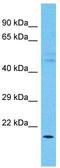 Cilia And Flagella Associated Protein 161 antibody, TA337776, Origene, Western Blot image 