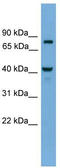 OTU Deubiquitinase With Linear Linkage Specificity Like antibody, TA331076, Origene, Western Blot image 