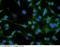 Cadherin 2 antibody, 11039-R017, Sino Biological, Immunohistochemistry paraffin image 