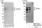 Zinc Finger And BTB Domain Containing 44 antibody, NBP1-78184, Novus Biologicals, Immunohistochemistry paraffin image 