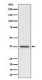 Chromosome 3 Open Reading Frame 38 antibody, M17229, Boster Biological Technology, Western Blot image 