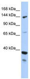 DEAH-Box Helicase 37 antibody, TA341625, Origene, Western Blot image 