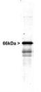 Internexin Neuronal Intermediate Filament Protein Alpha antibody, TA336609, Origene, Western Blot image 