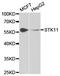 Serine/Threonine Kinase 11 antibody, TA327284, Origene, Western Blot image 