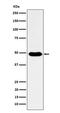 COP9 Signalosome Subunit 3 antibody, M07987-1, Boster Biological Technology, Western Blot image 