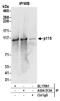 Rho GTPase Activating Protein 4 antibody, A304-513A, Bethyl Labs, Immunoprecipitation image 