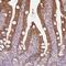 Coiled-Coil Serine Rich Protein 1 antibody, HPA054709, Atlas Antibodies, Immunohistochemistry paraffin image 