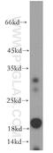 ADP Ribosylation Factor 6 antibody, 20225-1-AP, Proteintech Group, Western Blot image 