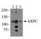 DNA repair protein complementing XP-C cells antibody, NB100-477, Novus Biologicals, Western Blot image 