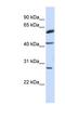 RING finger protein 170 antibody, NBP1-59759, Novus Biologicals, Western Blot image 