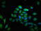 Matrix Metallopeptidase 28 antibody, LS-C672716, Lifespan Biosciences, Immunofluorescence image 