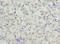 Solute Carrier Family 31 Member 2 antibody, A63438-100, Epigentek, Immunohistochemistry paraffin image 