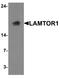 Late Endosomal/Lysosomal Adaptor, MAPK And MTOR Activator 1 antibody, TA326713, Origene, Western Blot image 