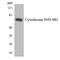 Cytochrome P450 Family 8 Subfamily B Member 1 antibody, LS-B12483, Lifespan Biosciences, Western Blot image 