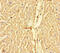Carnitine Palmitoyltransferase 1A antibody, CSB-PA005922LA01HU, Cusabio, Immunohistochemistry paraffin image 