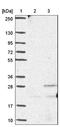 Ankyrin Repeat Domain 39 antibody, NBP1-91673, Novus Biologicals, Western Blot image 