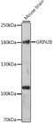 NMDAR2B antibody, 18-922, ProSci, Western Blot image 