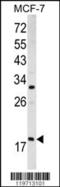 ADP-ribosylation factor 3 antibody, 62-354, ProSci, Western Blot image 
