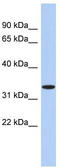 Aspartoacylase antibody, TA335130, Origene, Western Blot image 