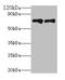 Kallikrein B1 antibody, LS-C681934, Lifespan Biosciences, Western Blot image 