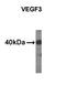 Vascular Endothelial Growth Factor C antibody, AM11019PU-N, Origene, Western Blot image 