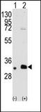 MAGE Family Member B2 antibody, AP13137PU-N, Origene, Western Blot image 