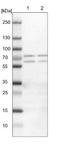 UPF3B Regulator Of Nonsense Mediated MRNA Decay antibody, NBP1-83134, Novus Biologicals, Western Blot image 
