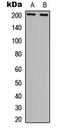 DNA repair protein complementing XP-G cells antibody, MBS8208332, MyBioSource, Western Blot image 