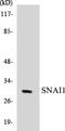 Snail Family Transcriptional Repressor 1 antibody, EKC1532, Boster Biological Technology, Western Blot image 