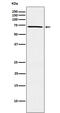 Maternal Embryonic Leucine Zipper Kinase antibody, M04038-1, Boster Biological Technology, Western Blot image 