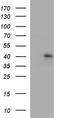 CD192 antibody, TA590046, Origene, Western Blot image 