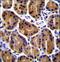 Plakophilin 2 antibody, LS-C163752, Lifespan Biosciences, Immunohistochemistry paraffin image 