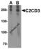 C2 Calcium Dependent Domain Containing 3 antibody, 8169, ProSci, Western Blot image 