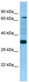 P-selectin glycoprotein ligand 1 antibody, TA338245, Origene, Western Blot image 