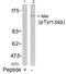 c-met antibody, GTX50270, GeneTex, Western Blot image 