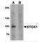 Storkhead Box 1 antibody, MBS150768, MyBioSource, Western Blot image 