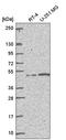 MutS Homolog 5 antibody, HPA062688, Atlas Antibodies, Western Blot image 