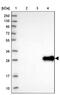 UTP11 Small Subunit Processome Component antibody, PA5-61100, Invitrogen Antibodies, Western Blot image 
