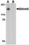 SLIT And NTRK Like Family Member 5 antibody, 4475, ProSci, Western Blot image 