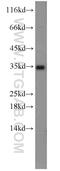 Insulin Like Growth Factor Binding Protein 1 antibody, 13981-1-AP, Proteintech Group, Western Blot image 