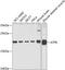 Mitochondrially Encoded ATP Synthase Membrane Subunit 6 antibody, GTX64448, GeneTex, Western Blot image 