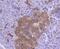 Coagulation Factor III, Tissue Factor antibody, GTX01033, GeneTex, Immunohistochemistry paraffin image 