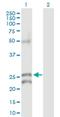 Gap Junction Protein Beta 5 antibody, H00002709-D01P, Novus Biologicals, Western Blot image 