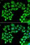 Carnitine O-Acetyltransferase antibody, orb247393, Biorbyt, Immunofluorescence image 